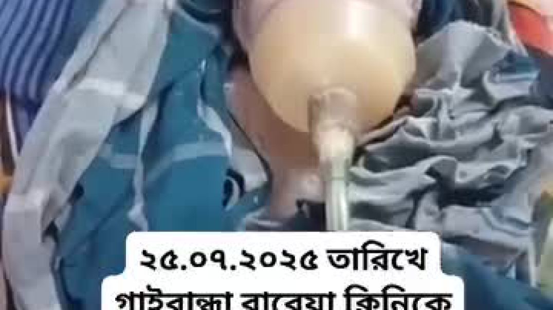 ⁣গাইবান্ধায় সিং ওয়ালা এবং একচোখা সন্তানের জন্ম।
