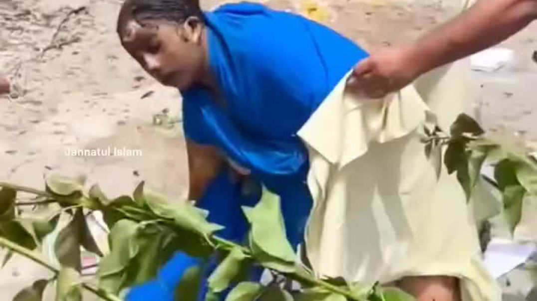 ⁣বিমান দু-র্ঘটনায় এখন পর্যন্ত ১৫ জন বার্ণ