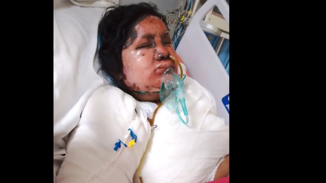 ⁣সবাই দোয়া করবেন আমার ভাই যেটা জেনে সুস্থ হয়