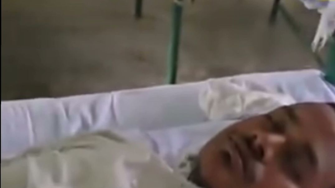 ⁣লাইভ করতে যেয়ে যুবককে সাপের দংশন