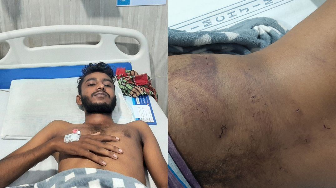 ⁣বাজিতপুরে অটো চালককে বেধড়ক মারধরের ঘটনায় থানায় অভিযোগ।
